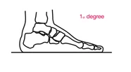 1st degree 1st degree