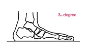 3rd degree 3rd degree